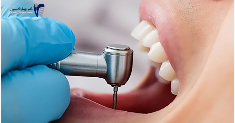 ابزارهای تخصصی دندانپزشکی